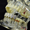 Two Tone Premium Iced CZ Bottom Teeth Grillz