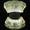 White Teeth Top & Bottom Grillz Set