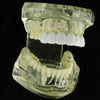 White Teeth Top & Bottom Grillz Set