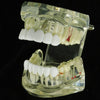 White Teeth Top & Bottom Grillz Set