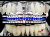 Silver Tone 3 Row Blue Iced Top Teeth Grillz