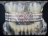 14K Gold Plated VIP Iced Three Row Top Teeth Grillz