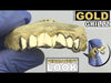 Real Solid 10K Gold Permanent Look Single Caps Custom Grillz