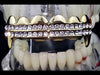 14K Gold Plated Two Row Iced Top Teeth Vampire Fangs Grillz