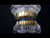 14K Gold Plated 8 on 6 Teeth Grillz Set