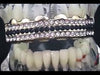 14K Gold Plated Iced Black Three Rows Top Teeth Grillz