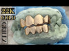 Real Solid 22K Gold Custom Grillz Teeth Grills or Single One Tooth Cap