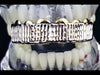 14K Gold Plated Diamond-Cut Top Teeth Grillz