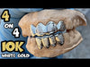 Real 10K White Gold Diamond Dust w/Border Custom Grillz