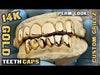 Real Solid 14K Gold  Permanent Look Single Caps Custom Grillz