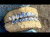 Real Solid 925 Sterling Silver Permanent Look Single Caps Custom Grillz