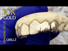 Real 10k Gold Full Diamond-Dust Custom Teeth Grillz