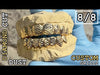 Gold Plated 925 Sterling Silver Diamond Dust Diamond-Cut Custom Grillz