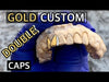 Real 14K Gold Double Side Canine Teeth Custom Grillz