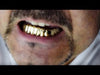 14K Gold Plated 3-Row Black Iced Bottom Teeth Grillz