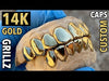 Real Solid 14K Gold  Permanent Look Single Caps Custom Grillz
