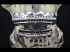 Silver Tone Two-Row Black & White Iced Grillz Set