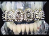 14K Gold Plated Iced Crown Top Teeth Grillz