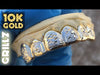 10K Gold Two-Tone Diamond-Cut Diamond Dust Custom Grillz
