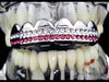 Silver Tone Two-Row Pink Iced Top Teeth Grillz